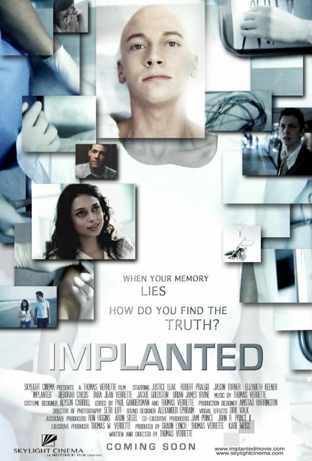 Постер к Имплант (2013)